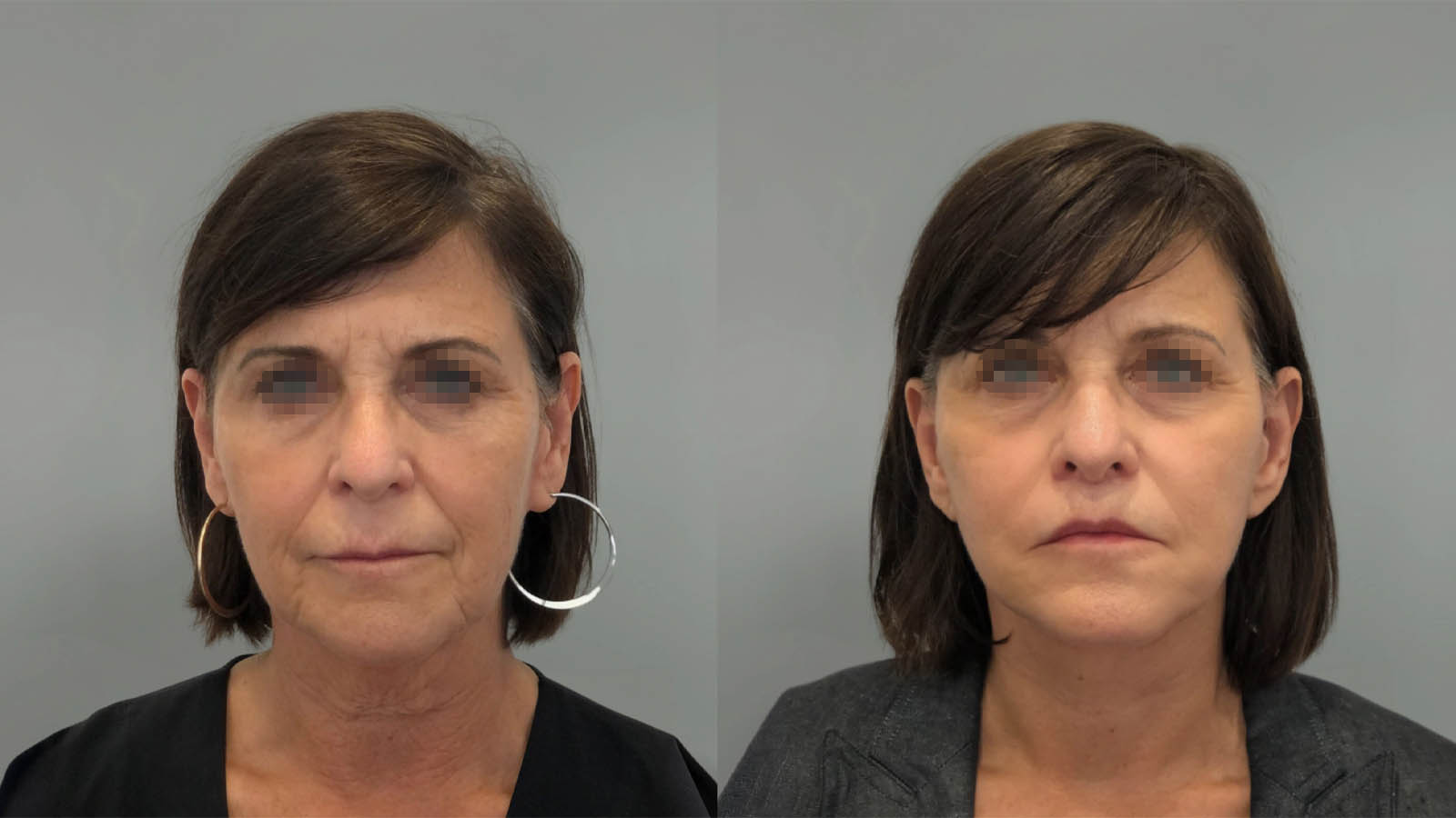 1_0044_facelift046of27.webp