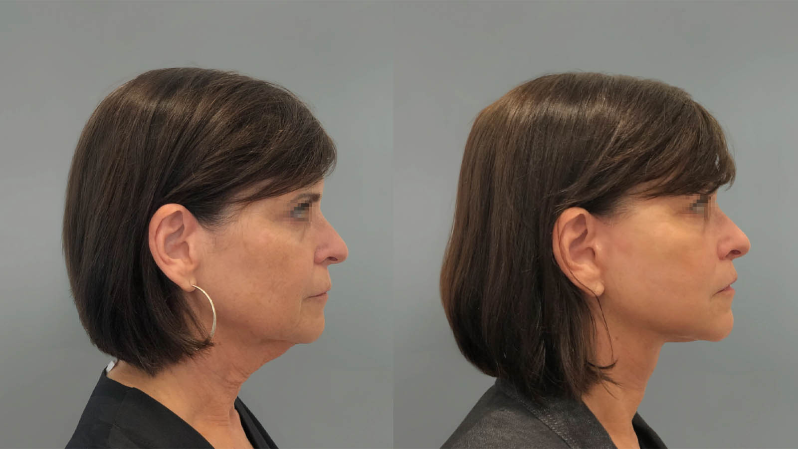 1_0048_facelift050of27.webp