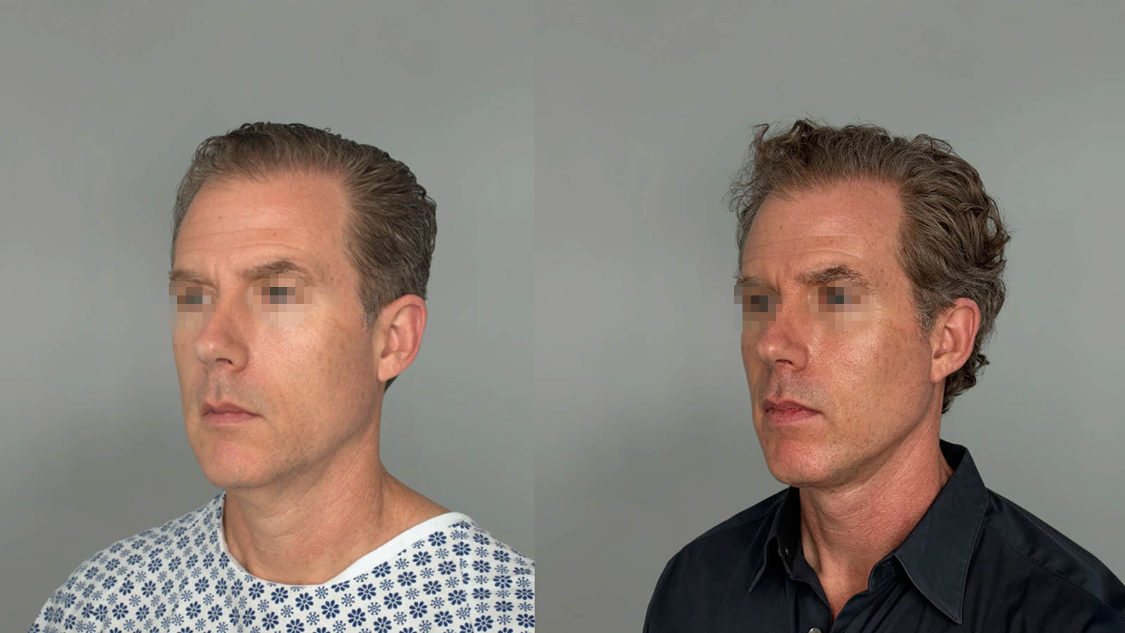 1_0024_facelift025of27.jpg