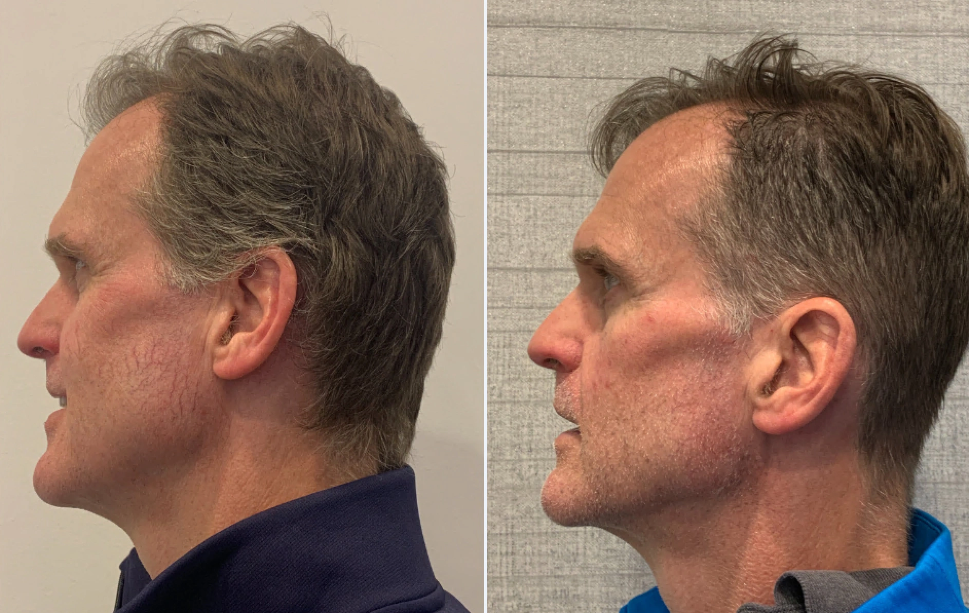 Ellet, T Pre2.png
