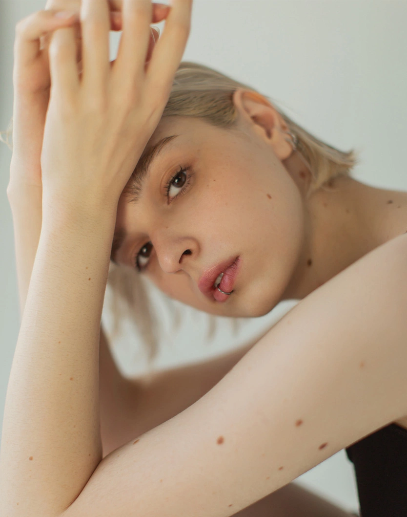 Natural beauty portrait of woman with freckles resting hand on forehead, minimalist aesthetic